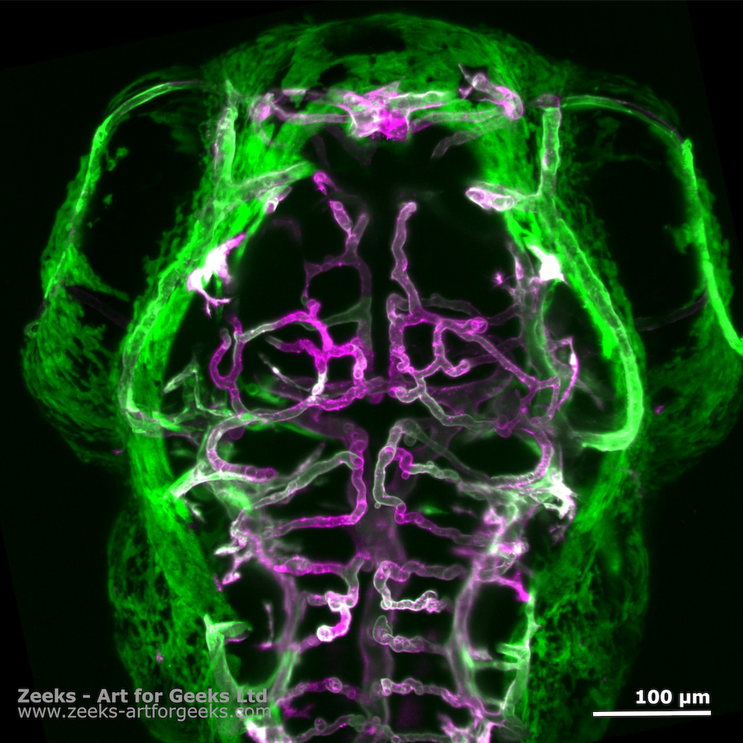 Under the Microscope – Visualizing Blood Vessels in the Brain of Zebrafish
